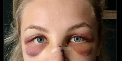 2020 attack images unrelated to Manchester Airport incident 