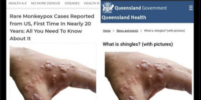 mpox is not a side effect